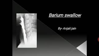 Barium swallow [upl. by Anihta457]