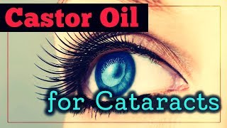 Castor Oil For Cataracts Does It Work And How To Use It [upl. by Daryle]