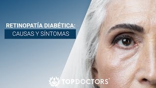 Retinopatía Diabética causas y síntomas [upl. by Rednal]