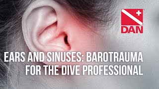 Ears and Sinuses Barotrauma for the Dive Professional [upl. by Adnyc]