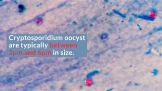 Cryptosporidium Filtration [upl. by Novy]