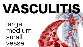 Vasculitis [upl. by Zelma]