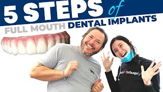 Full Mouth Dental Implant Procedure StepbyStep [upl. by Einhapets]