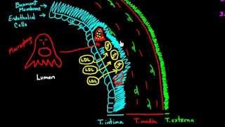 Atherosclerosis  Part 1 [upl. by Asaret623]