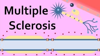 Multiple Sclerosis and the Myelin Sheath [upl. by Sheya]