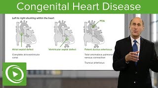 Congenital Heart Defects Quick amp EZ Episode 1 [upl. by Faludi]