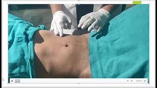 2 Abdominal Examination [upl. by Starr]