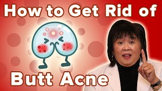 How To Get Rid Of Butt Acne [upl. by Adnolor]