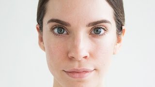 HOW I HEALED MY ACNE SCARS NATURALLY [upl. by Maleki624]