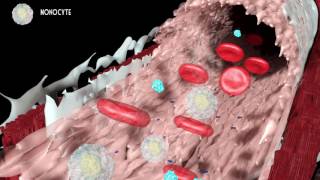 Development of atherosclerosis [upl. by Yddeg]