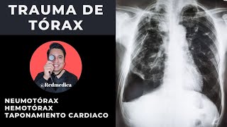 ATLS  Trauma de tórax  ENARM2021  🩺Dr Treviño [upl. by Caritta]