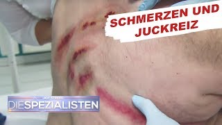 Krasser Hautausschlag  Auf Streife  Die Spezialisten  SAT1 TV [upl. by Inahs]