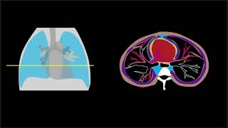 Pneumomediastinum Explained by Prometheus Lionhart MD [upl. by Maidel]