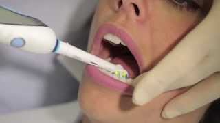 How to use an electric toothbrush  AJ Hedger [upl. by Ylremik]