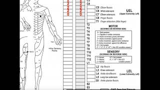 Nerve Injury  Nerve Damage  ANIMATION  Neuron  The Young Orthopod [upl. by Yelena156]