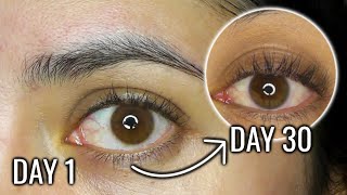 CASTOR OIL FOR EYELASH GROWTH  30 DAY BEFORE AND AFTER RESULTS [upl. by Anilef]