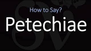 How to Pronounce Petechiae CORRECTLY Meaning amp Pronunciation [upl. by Yraillih]