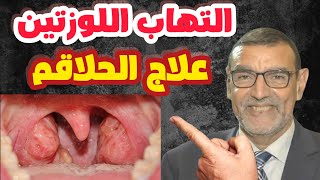 علاج الحلاقم الدكتور محمد الفايد [upl. by Noillimaxam]