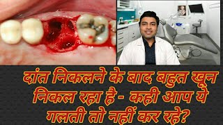 Bleeding after tooth extraction how to stop  Bleeding after tooth removal  Dr Pranay Thakkar [upl. by Vassar]