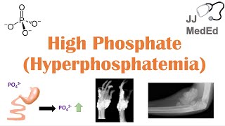 High Phosphate Hyperphosphatemia Dietary Sources Causes Symptoms Treatment [upl. by Warchaw]