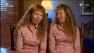 These Twins Were Named quotThe Most Beautiful Twins In The Worldquot [upl. by Nirrok489]