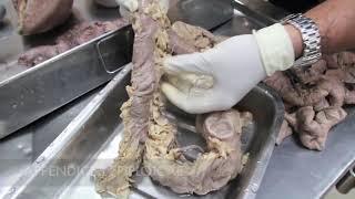 Anatomy Dissection of Large amp Small Intestine [upl. by Nerrag99]