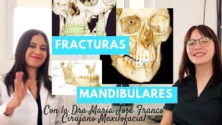 Fracturas Mandibulares [upl. by Nhguaved74]