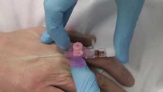 Cannulation How to gain IV access [upl. by Sivartal957]