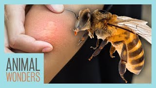 What You Need To Know About Bee Stings [upl. by Bogoch]