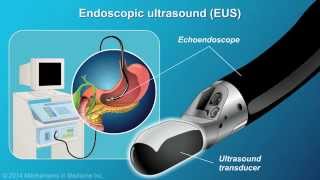 Understanding EUSFNA [upl. by Blase]