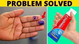 Simplest Way to Remove Dried Fountain Pen Ink Stains From Hands and Skin  Cleaning Solutions [upl. by Adnalu]