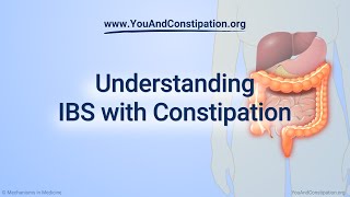 Tips for Managing Constipation [upl. by Tisman57]