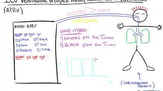 Basic Vent Modes MADE EASY  Ventilator Settings Reviewed [upl. by Shaper]