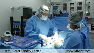 West Coast Fertility Centers Male Infertility Treatments [upl. by Medin923]