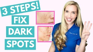 Fix Your Dark Spots in 3 Steps  Hyperpigmentation  Melasma  Skincare Made Simple [upl. by Intyrb]