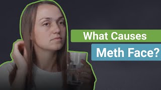 What Causes Meth Face [upl. by Enyedy]