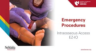 Emergency Procedures Intraosseous Access  EZIO [upl. by Calandra]