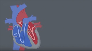 Congenital Heart Defects CHDs [upl. by Dnivra]