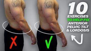 10 Exercises to Help Fix Anterior Pelvic Tilt amp Lordosis [upl. by Denoting740]