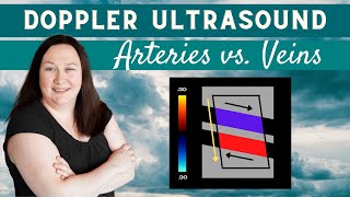 Doppler Ultrasound Arteries vs Veins [upl. by Aniuqaoj]