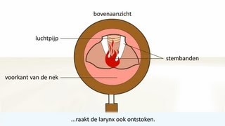 Keelontsteking  de oorzaak en behandeling [upl. by Ahsieni488]