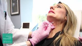 Platysmal Neck Band Treatment Botox Demonstration by Dr Monica Boen [upl. by Petracca562]