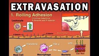 EXTRAVASATION [upl. by Quartana472]