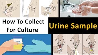 How to Collect Urine Sample For Culture [upl. by Boutis]