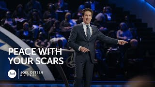 Joel Osteen  Peace With Your Scars [upl. by Whitman263]