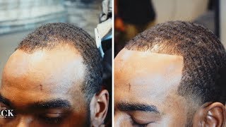 Barber Shows How To Get Your Thinning Hairline Back  Barber Spotlight 4 Tahir Woods [upl. by Coughlin]