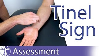 Tinel Sign Wrist  Carpal Tunnel Syndrome Diagnosis [upl. by Gosney355]