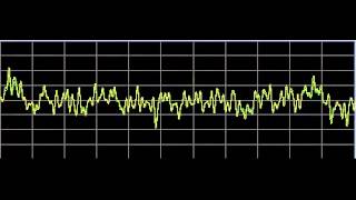 Vision Disorders  Rife Frequencies [upl. by Yllas]