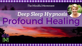 Use Your Powerful Mind Healing Deep Sleep Hypnosis  Mindful Movement [upl. by Arodoeht]