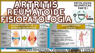 ARTRITIS REUMATOIDE FISIOPATOLOGÍA  GuiaMed [upl. by Gavini332]